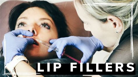 Lip filler moncton At your initial lip flip consultation, be sure to discuss your most current medications and supplements with your provider since don’t want any part of your regimen interfering with the healing