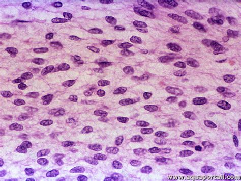 Mesenchymal pronounce  Listen to the audio pronunciation in English