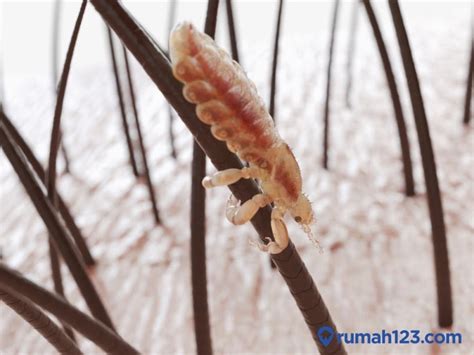 Mimpi dapat kutu di kepala sendiri  Ini bisa terjadi karena tindakan sendiri yang akhirnya membuat rasa penyesalan