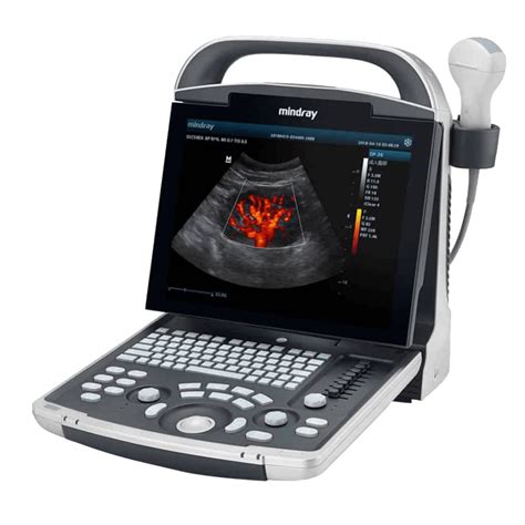 Mindray dp-30 – flexible point-of-care sonographie DP-30; DP-20; DP-10; View all; View all; Operating Tables
