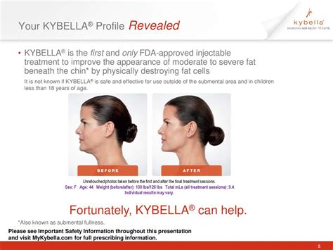 Navarre kybella  With our state-of-the art technology, we can safely remove unwanted body hair from almost anywhere on the body—usually legs, back or face—with minimal discomfort for years to come