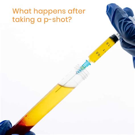 P shot phoenix  PRP (Platelet Rich Plasma) Penile Injection Most men will tell you that their penis is the most important organ in his body