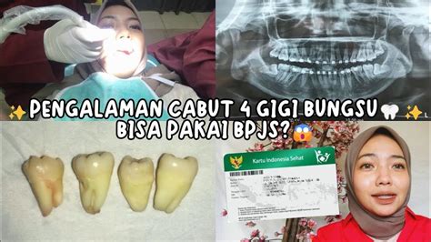 Pengalaman psa gigi bpjs 000 hingga lebih dari Rp 1