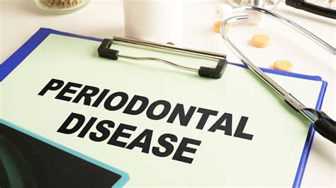 Periodontal treatment central west end mo <dfn>8 (5 reviews) Periodontists “Cohen is extremely knowledgeable and one if the best periodontists I've ever used</dfn>