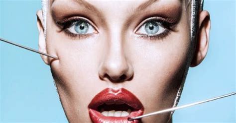 Plastic Surgery Case Studies: An Addiction of the Rich and Famous
