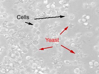 Pneumaticcraft yeast culture  The aim of this study was to investigate the effects of yeast culture (Saccharomyces cerevisiae) supplementation on the growth performance, meat quality, gut health, and microbiota community of growing–finishing pigs
