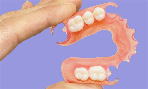 Prótese dentária de silicone flexível fotos  As próteses dentárias substituem dentes