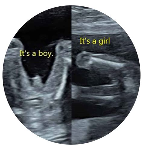 Private gender scan doncaster  They’ve all be right! Our first was a boy, second was a girl, third was a girl, and this one is a very obvious boy 😆