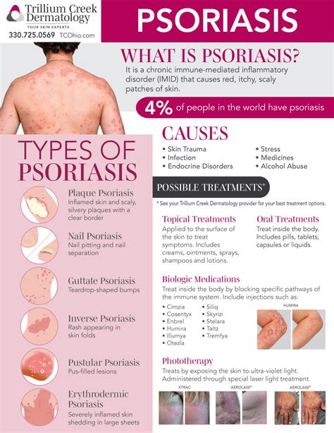 Psoriasis treatment greenville tx  Relieved to be off the drugs