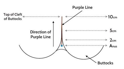 Purple line dilation  Here are the best content by the team thcsnguyenthanhson