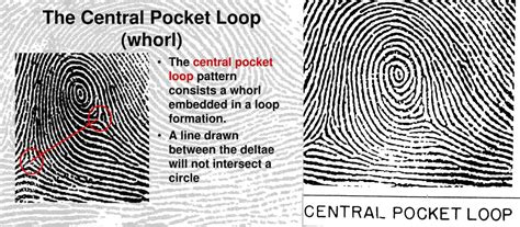 Rarest fingerprint patterns  The most common pattern is the ulnar loop