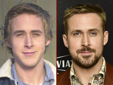 Rhinoplasty side view ryan gosling nose  The side profile view has been my biggest concern