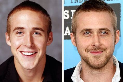 Rhinoplasty side view ryan gosling nose  The TikTok star and co-founder of The Clubhouse admitted on her then-boyfriend's, RiceGum, YouTube channel in July 2019 that she got breast implants