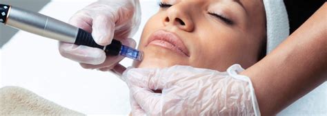 Skinpen treatment in las olas fl  SkinPen II is a micro-needling system that reverses signs of aging