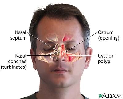 Snot traducere  أنا ستقاضي قليلا المخاط عن الإخلال بالعقد