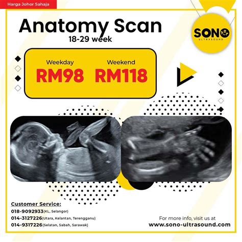 Sonobee ultrasound kuantan reviews  Might change is future | Ketahui lebih lanjut tentang pengalaman kerja, pendidikan, kenalan & banyak lagi berkaitan Husna Ismail dengan melawat profil mereka di LinkedIn