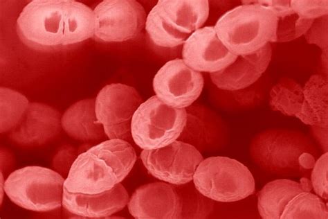 Streptococcus lactis digunakan untuk Lactobacillus bulgaricus, Streptococcus thermophyllus dan Streptococcus lactis digunakan dalam pembuatan yoghurt b