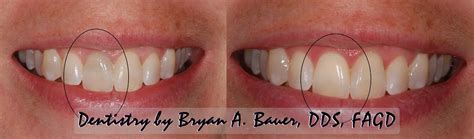 Teeth whitening price cdo  Smiles By CDO is a San Antonio pediatric