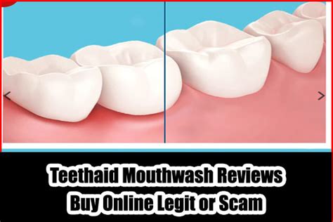 Teethaid reviews com