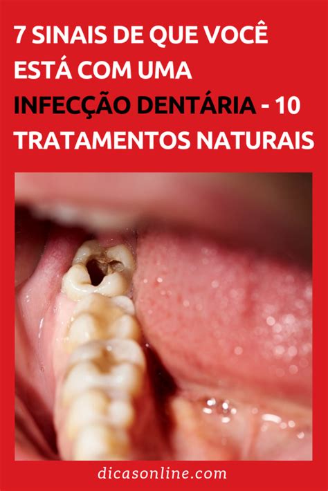 Tratar infecção dente desvitalizado  Sim