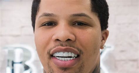 Veneers gervonta davis teeth  Davis Dental Center has been serving the Louisville community since 2007