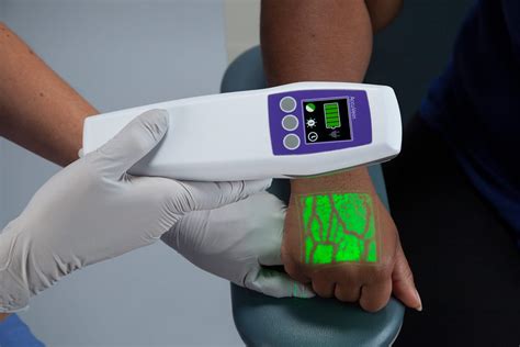 Who stole the vein detector  The designed vein detection takes a snapshot of the subject's veins under a source of infrared radiation