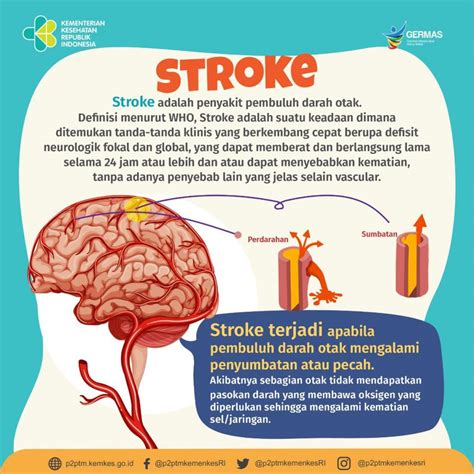 apa itu stroke motor  Saat jarak tempuh mobil mencapai 10