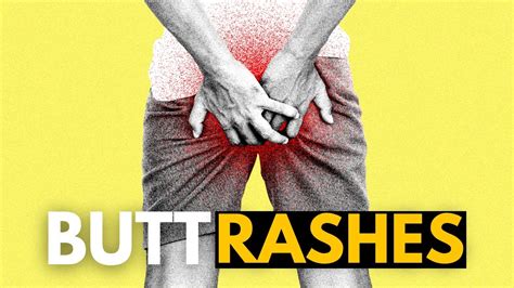 asscrack rash  Many possibilities: Including recurring fungal infection and mechanical irritation