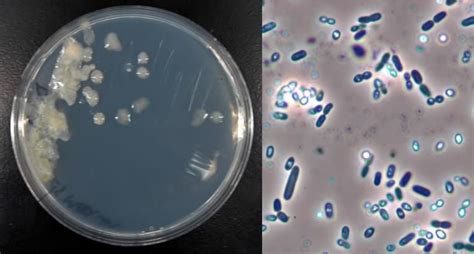 azotobacter  Azotobacter species possess some unique features such as cysts formation (Sadoff, 1975)