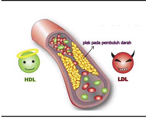 batang dalam darah Dalam dunia medis, tes hematologi merupakan sebuah pemeriksaan darah lengkap yang meliputi sel darah putih, sel darah merah, dan platelet