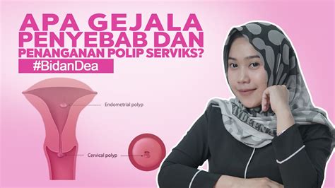 bentuk serviks Ciri-ciri vagina sehat