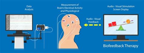 biofeedback therapy schaumburg View