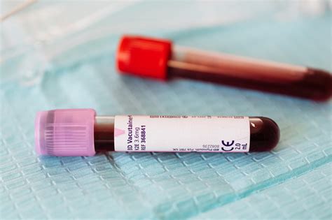 blood test clsc laval  Prélèvement sanguin 45$, service privé de prélèvement, abordable