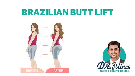 brazilian butt lift omaha !” — My M