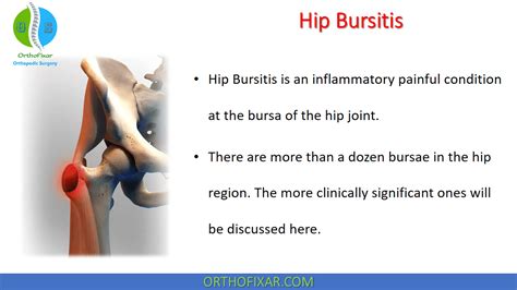 bursitis hip treatment natural  Other causes of trochanteric bursitis include: muscle tears