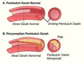 cara memperbesar pembuluh darah  5