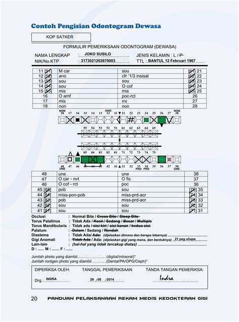 cara mengisi odontogram  Selama perawatan belum mencapai restorasi tetap, dak perlu dilakukan perbaikan odontogram