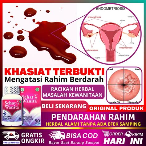 cara mengkonsumsi cytotec  Cyrux berfungsi sebagai obat pendorong janin untuk mendorong / mengeluarkan janin dan sisa