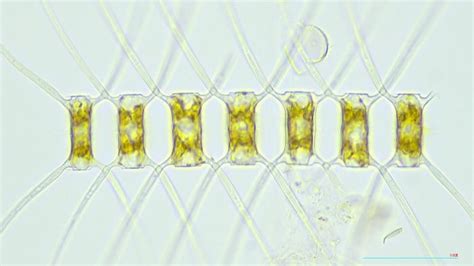 chaetoceros Among diatoms, the Chaetoceros genus is the most abundant and diverse group, accounting for 23