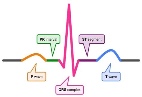 contoh ekg normal  Ukuran pada EKG standar dengan kecepatan 25 mm/s dan voltase 10 mm b