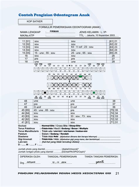 contoh pengisian odontogram gigi  Pada gigi permanen gigi yang berada diatas kiri atas disimbolkan dengan kuadran 1, gigi daerah atas kanan disimbolkan dengan kuadran 2, gigi daerah bawahPengertian Odontogram adalah gambaran peta mengenai keadaan gigi geligi di dalam