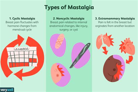 cyclical mastalgia icd 10  The review included