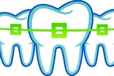 dental braces ladysmith  Remember to look over your dental insurance and that your dentist accepts it
