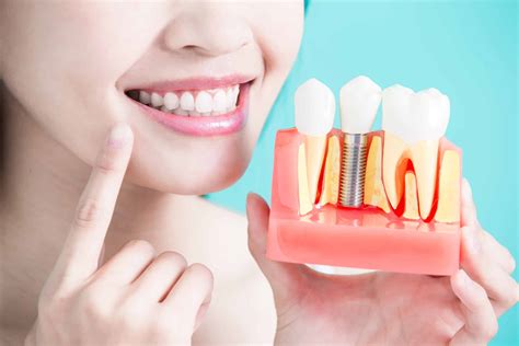 dental implants wenatchee wa  Wenatchee, WA 98801