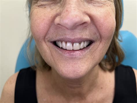 denture clinic buderim  When your smile can’t wait, we make getting quick, affordable denture services simple