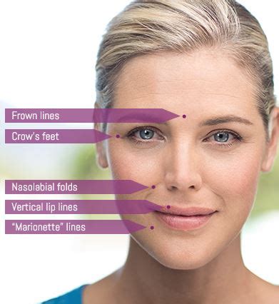 dermal fillers sammamish The latter "freezes" muscles to reduce wrinkles, while dermal fillers are injectable implants approved by the FDA to help smooth skin and wrinkles