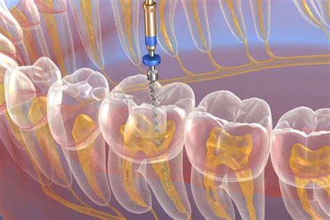 endodontics mooroolbark  Manchester Rd Dental Surgery is a well established family based practice, which has been servicing Mooroolbark and our local community’s dental needs for over 30&#8230; Our attentive and skilled Mooroolbark dentists provide personalised modern orthodontic services for child and adult patients