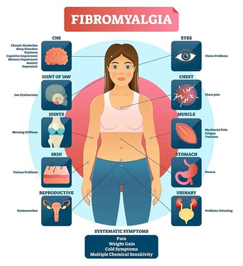 fibromyalgie et cbd For people with fibromyalgia, a condition causing chronic pain and fatigue, CBD can be a helpful tool in a range of treatment options