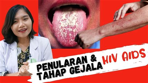 foto hiv id, 3/08/2015] Penularan Human Immunodeficiency Virus (HIV) AIDS di Indonesia termasuk tinggi
