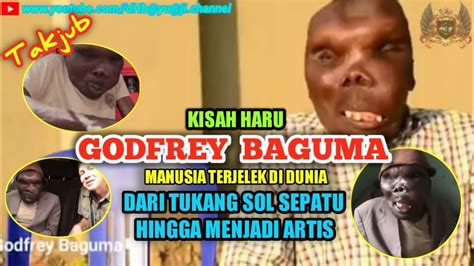godfrey baguma wikipedia  The man has been born with a very strange disability that has caused his face to form in a different way